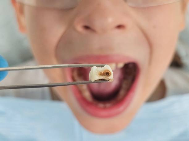 Best Emergency Pediatric Dental Care in La Riviera, CA
