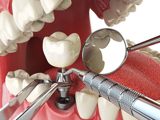 Best Walk-In Emergency Dental Services in La Riviera, CA