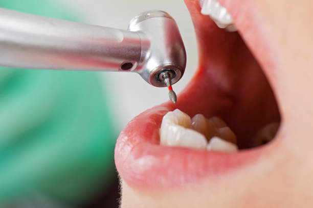 Best Emergency Treatment for Jaw Pain or Injury in La Riviera, CA
